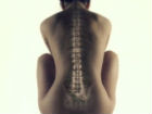 L'Osteoporosi e le donne